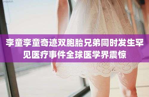 孪童孪童奇迹双胞胎兄弟同时发生罕见医疗事件全球医学界震惊